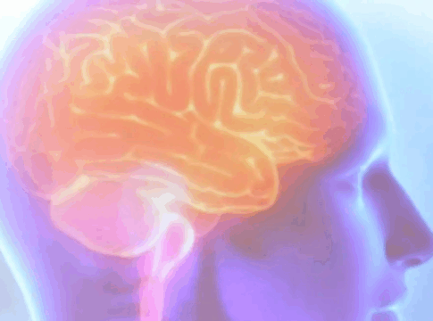 Por que o AVC vem afetando mais jovens de 18 a 45 anos?