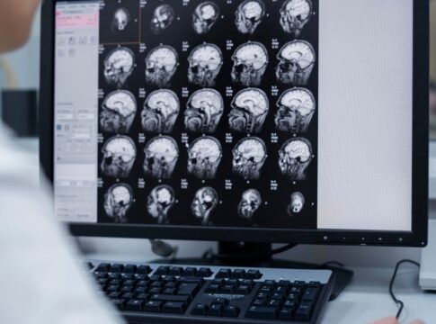 Médico observa exames de imagem do cérebro de um paciente