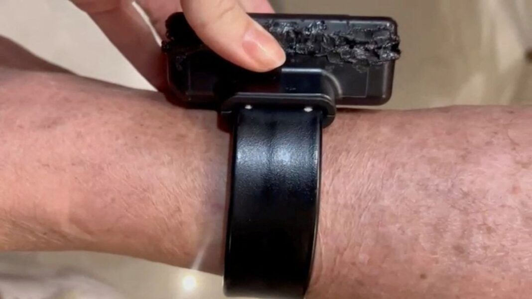 Uma mão segura a tornozeleira eletrônica na perna do ex-presidente Jair Bolsonaro