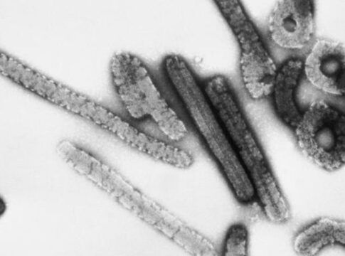 Etiópia confirma 14 casos e 9 mortes por vírus Marburg