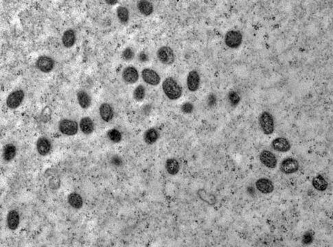 SP: Segundo caso de nova variante de mpox é confirmado no estado